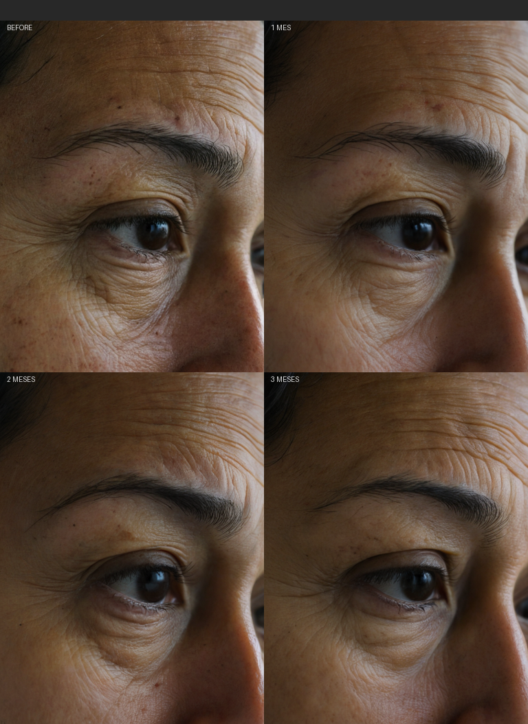 Resultados Colormax - Antes y Después