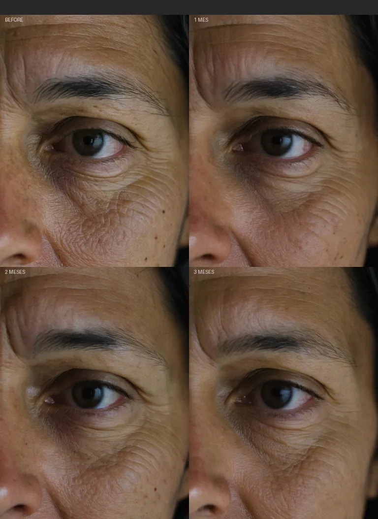 Resultados Hydrash - Antes y Después