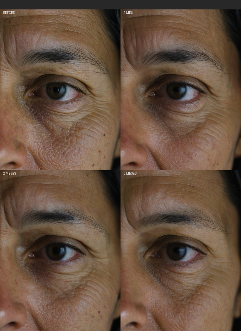Resultados Hydrash - Antes y Después