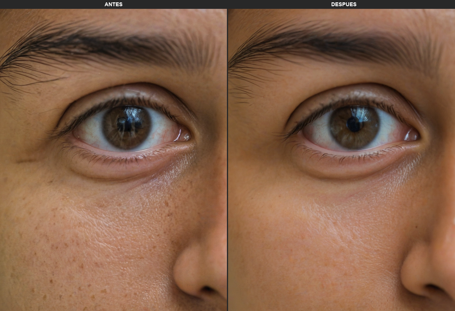 Resultados Iblaze - Antes y Después